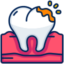 Early Childhood Tooth Decay
