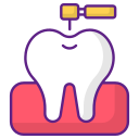 Tooth Coloured <br>Filling