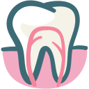 Root Canal Treatment